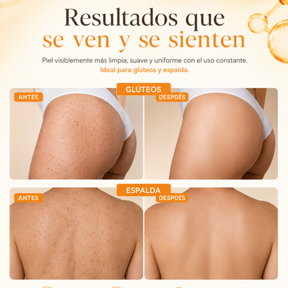 Piel en Balance™