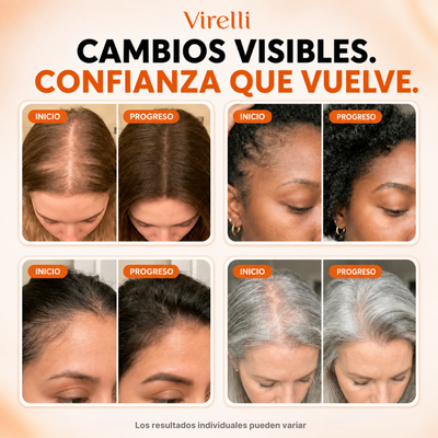 El Serúm para el crecimiento del Cabello Número 1 de Corea