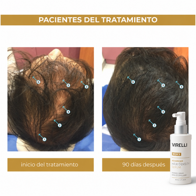 Nanoxidil Men's® Loción Capilar Virelli