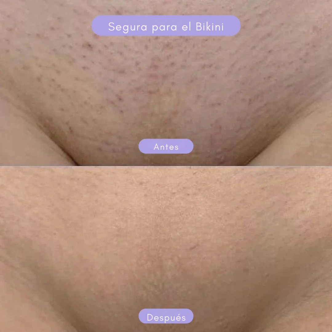 Piel en Balance™