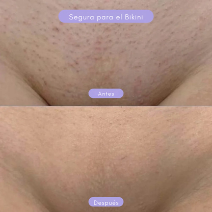 Piel en Balance™